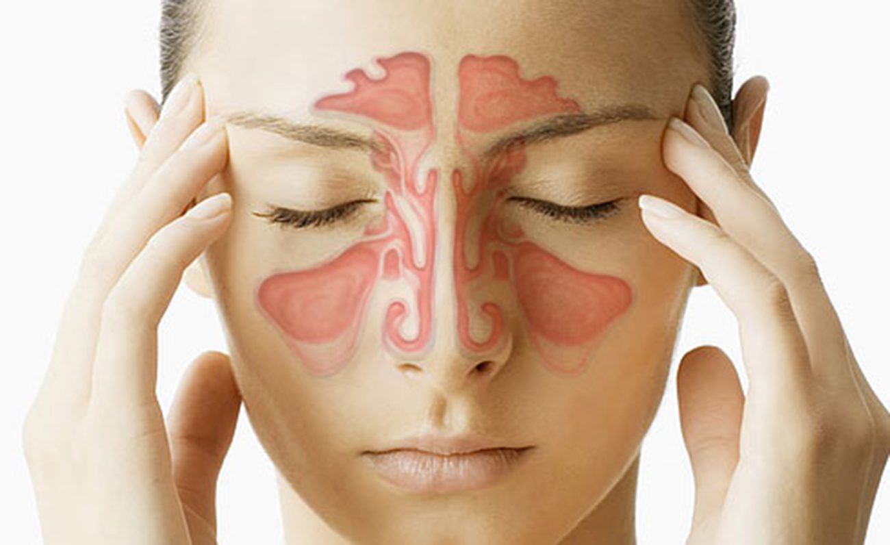 Sinusite: O Que É e Como Tratar o Problema
