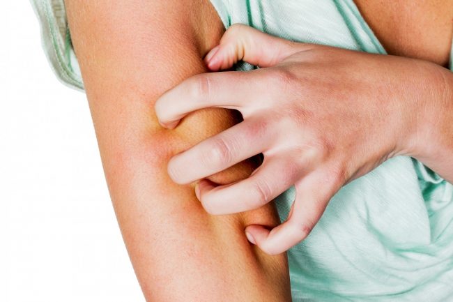 Dermatite Atópica: Causas, Sintomas e Tratamentos