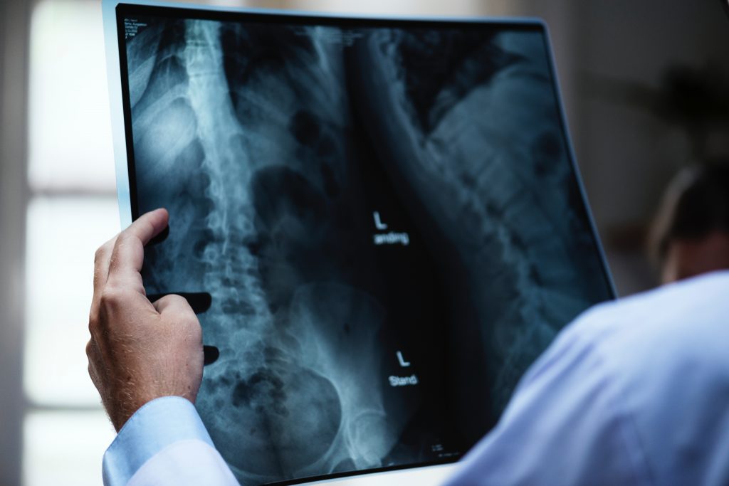 Médico olhando raio x de paciente com osteoporose