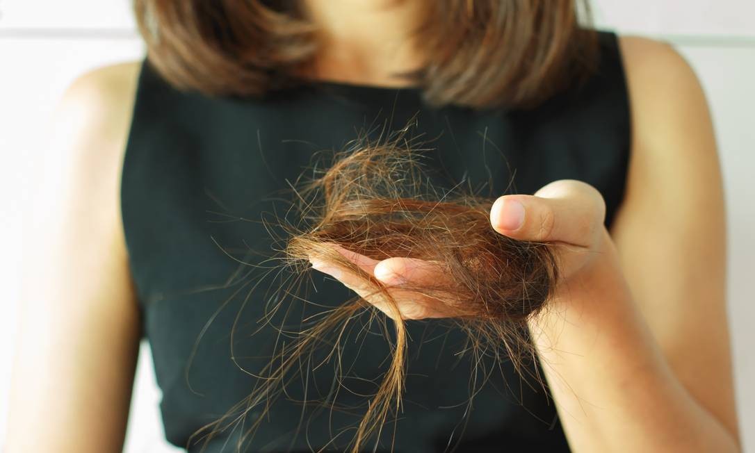 Queda de cabelo excessiva o que pode ser?