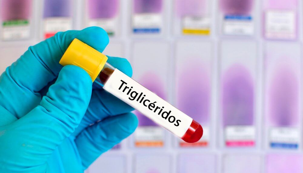 Baixar triglicerídeos: A relação entre colesterol e triglicérides